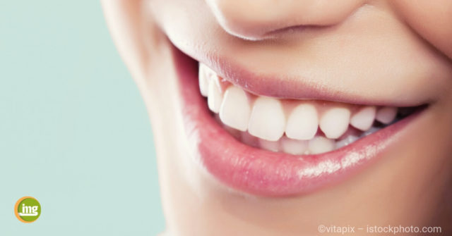 Junge Frau lächelt mit weißen Zähnen nach dem Bleaching beim Zahnarzt.
