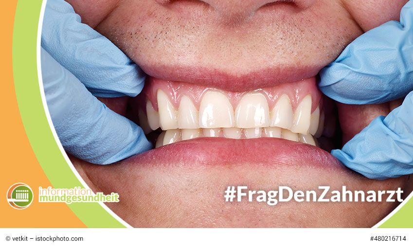 wie wird die parodontitis behandelt? frag den zahnarzt auf information mundgesundheit