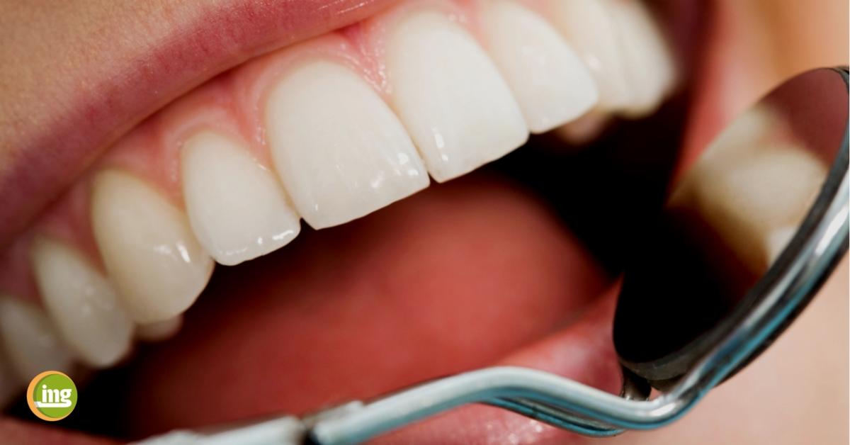 mund mit zähnen bei der professionellen zahnreinigung in der zahnarztpraxis