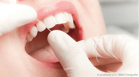 Zahnseide zwischen zwei Fingern vor geöffnetem Mund einer Patientin in der Zahnarztpraxis