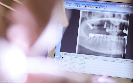 Thema Zahnimplantate: Am Computer geplante Implantologie. Betrachtung eines Röntgenbildes am Computerbildschirm.