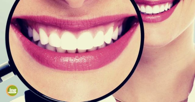 Weißmacher-Zahncremes enthalten in der Regel viele, grobe Putzkörper. Die entfernen Plaque von den Zähnen und "reiben" die Verfärbungen oberflächlich vom Zahnschmelz. 